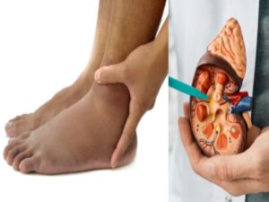 Read more about the article बार-बार पेशाब आना या शरीर में सूजन? किडनी फेल होने के ये हो सकते हैं संकेत